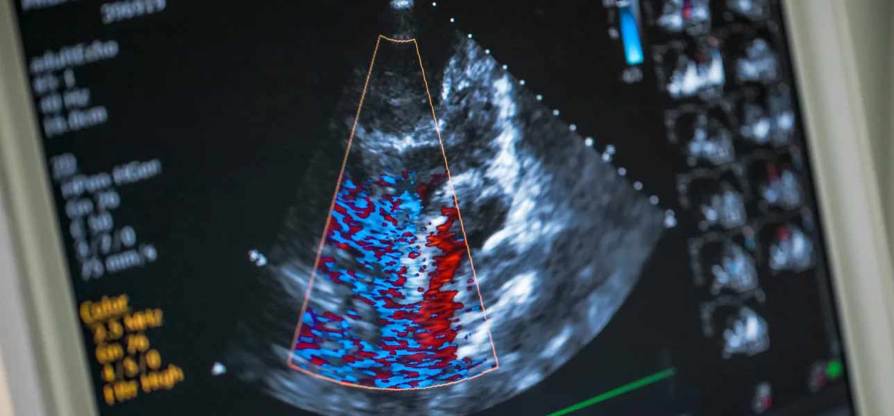 electrocardiogramas a pacientes mayores en laboratorios medicos humanas