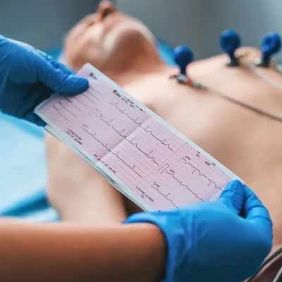 estudios clinicos de electrocardiogramas y ecocardiogramas